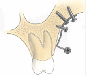 Schermafbeelding-2020-04-09-om-17.31.08