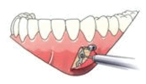 Schermafbeelding-2020-04-09-om-17.33.08