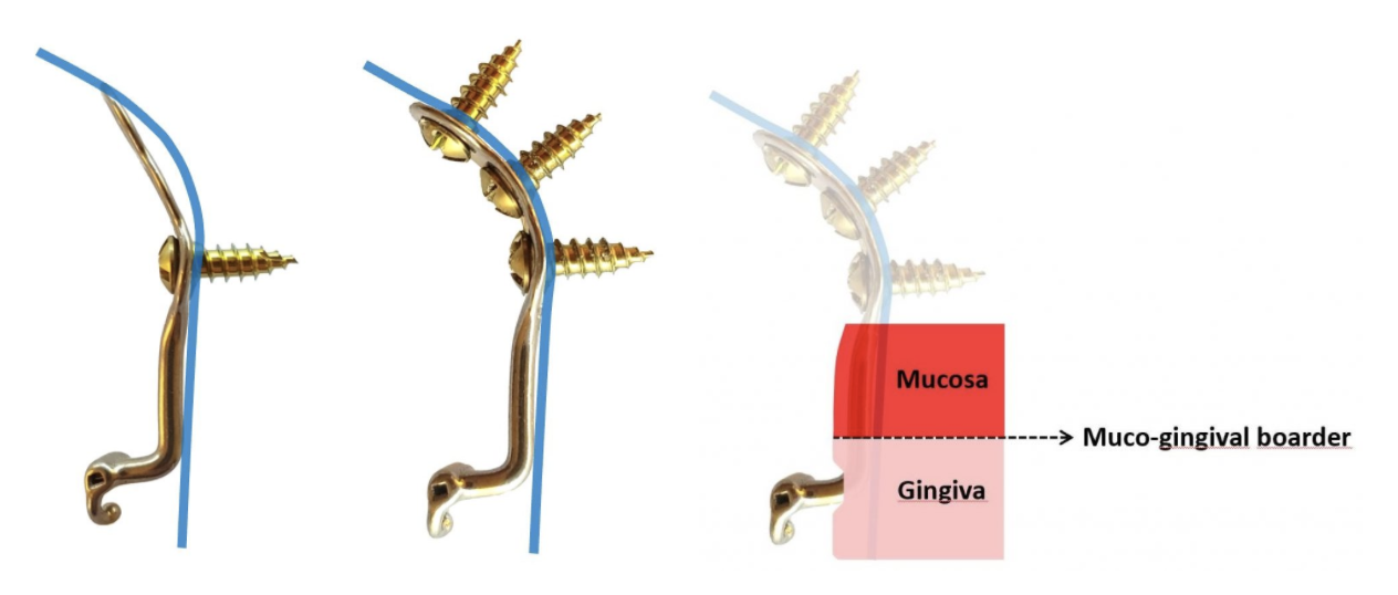 Schermafbeelding-2020-06-05-om-16.17.55